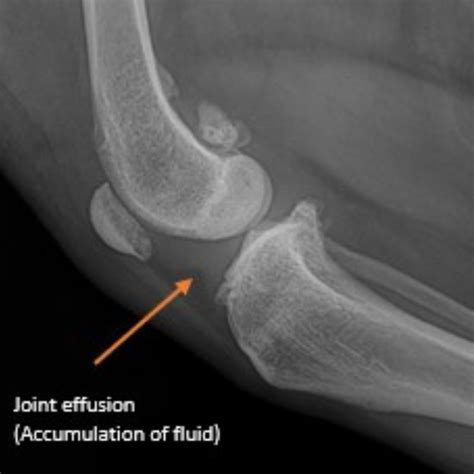 cranial cruciate ligament rupture diagnostic test